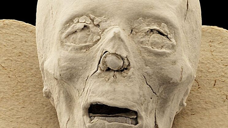 Photon-counting CT is letting scientists see the bones, teeth and bandages of Egyptian mummy remains more than 2,300 years old without disturbing them