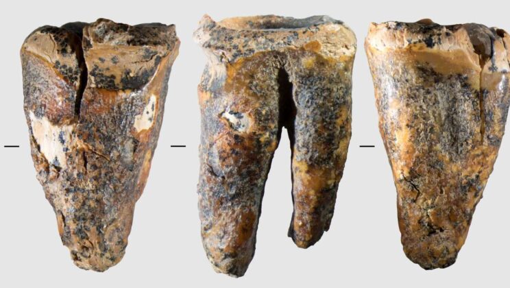 Neanderthal used a stone tool to drill into a painful, infected tooth 59,000 years ago